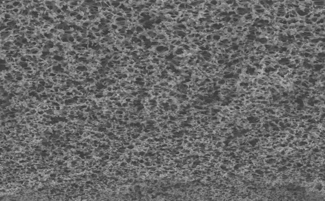 Microscopy image of PES