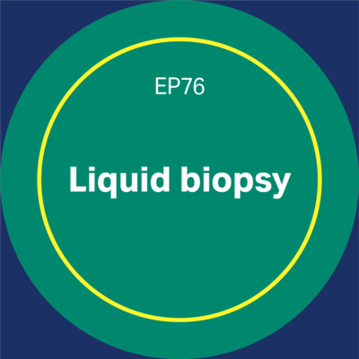 Episode 76 - Liquid biopsy