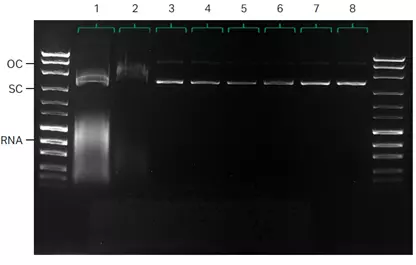 Control of pDNA downstream step