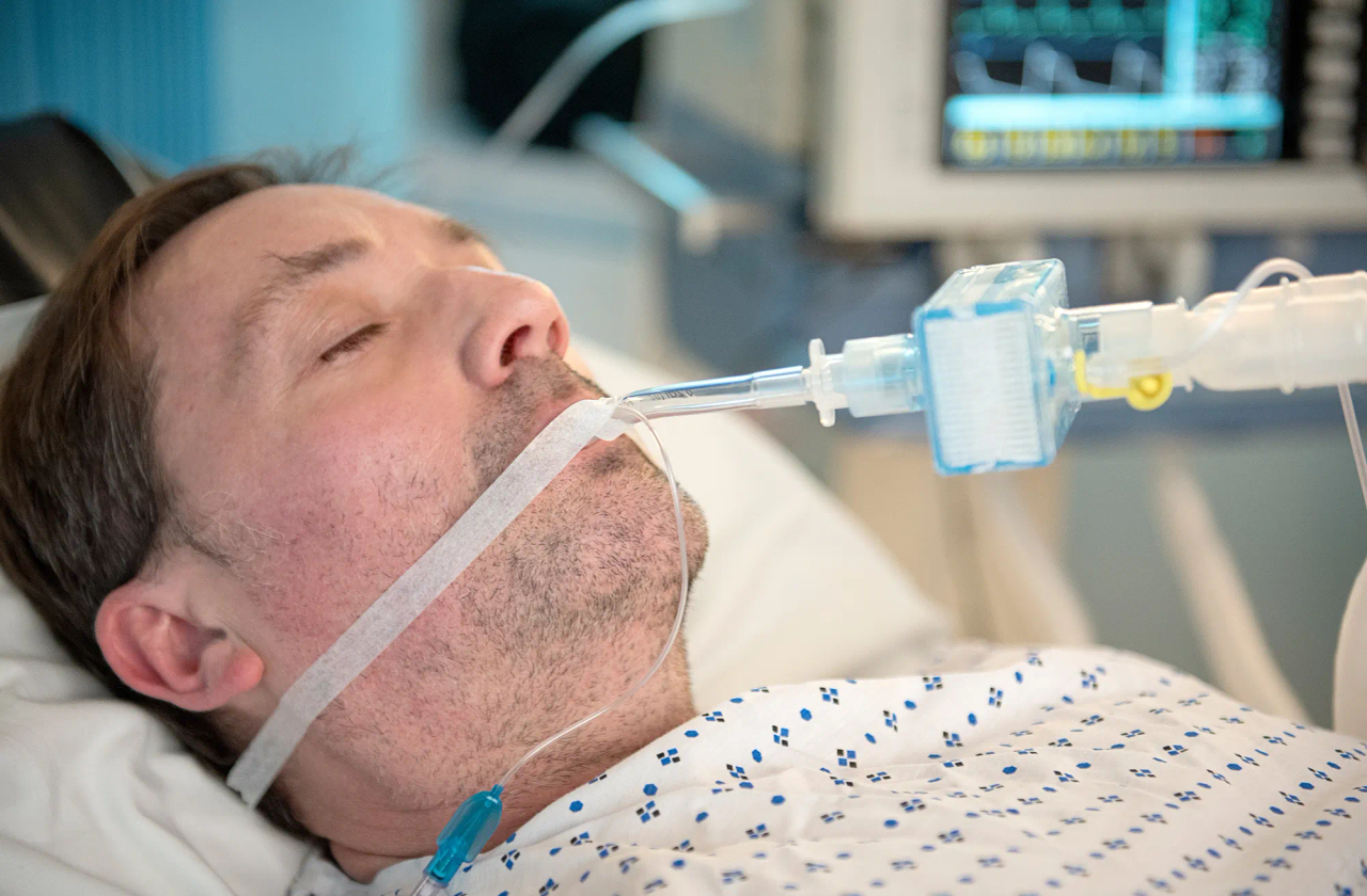 Patient undergoing ventilation with Pall Medical intensive care solutions