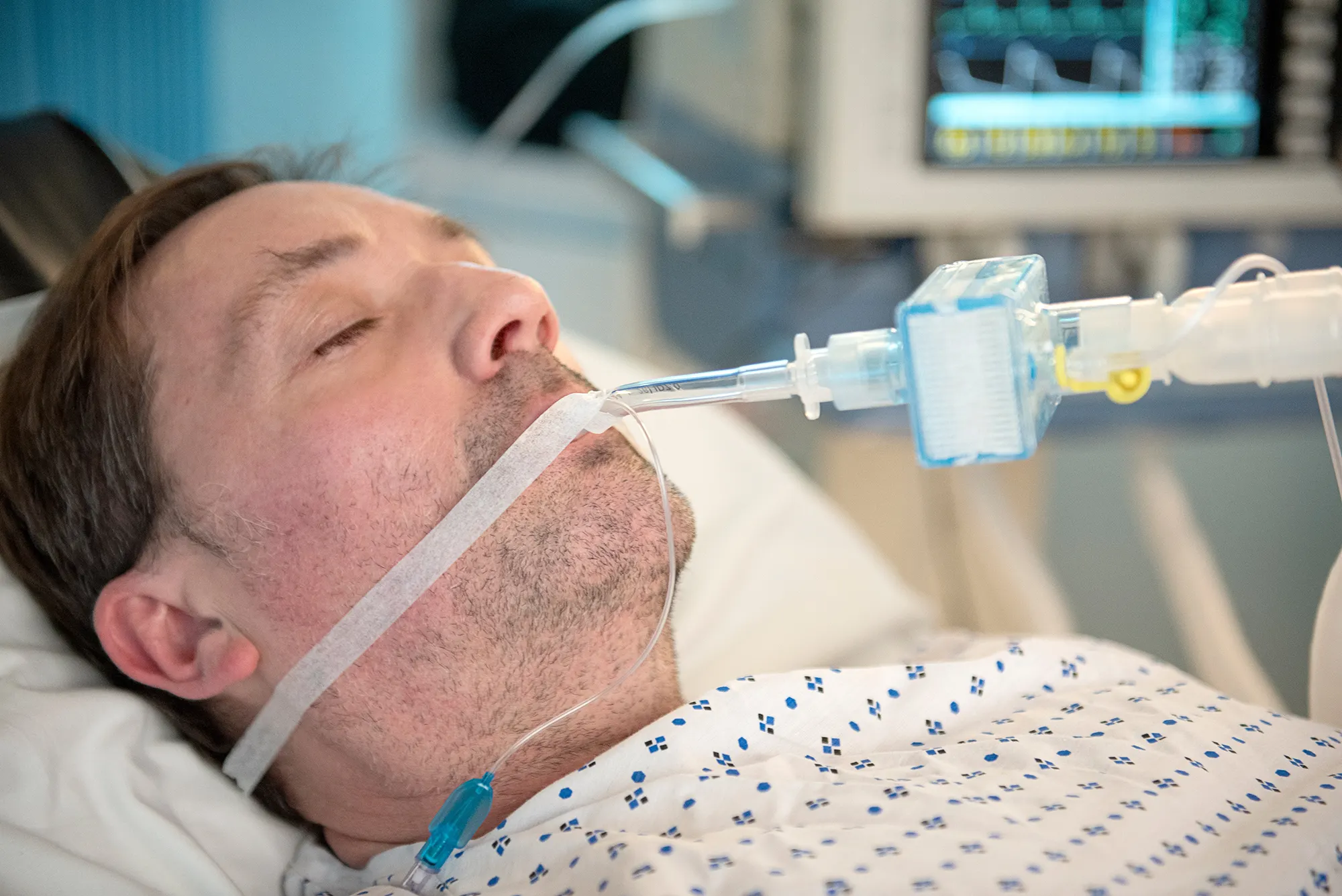 Patient undergoing ventilation with Pall Medical Intensive Care Solutions