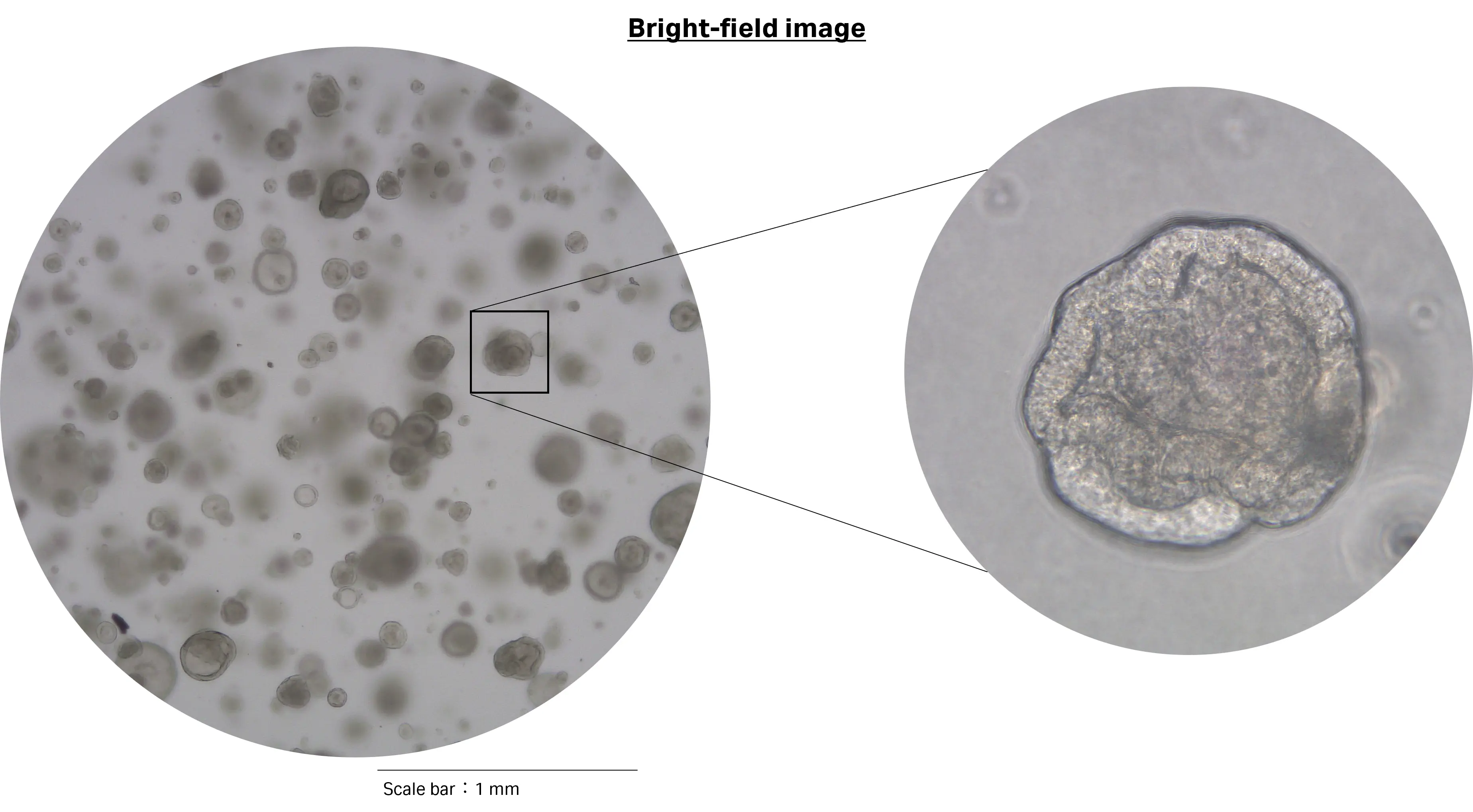 CytoFLEX SRTで細胞を分取後、マトリゲル下で12日間培養したAT2オルガノイドの明視野画像