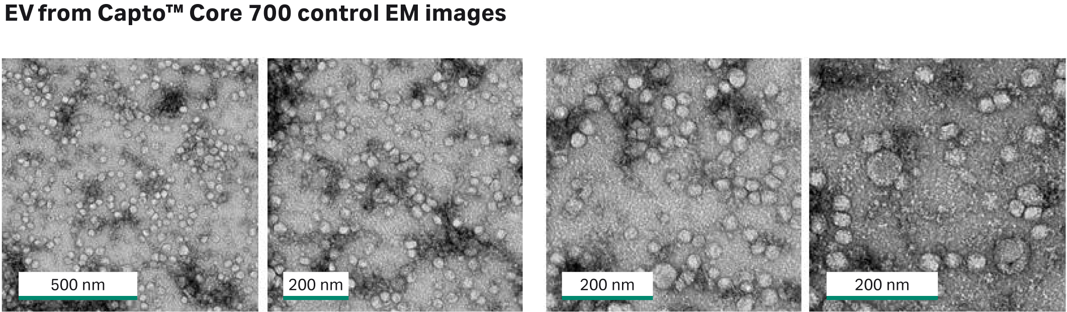 Electron microscopy images from flowthrough fraction after purification with Capto™ Core 700 beads.