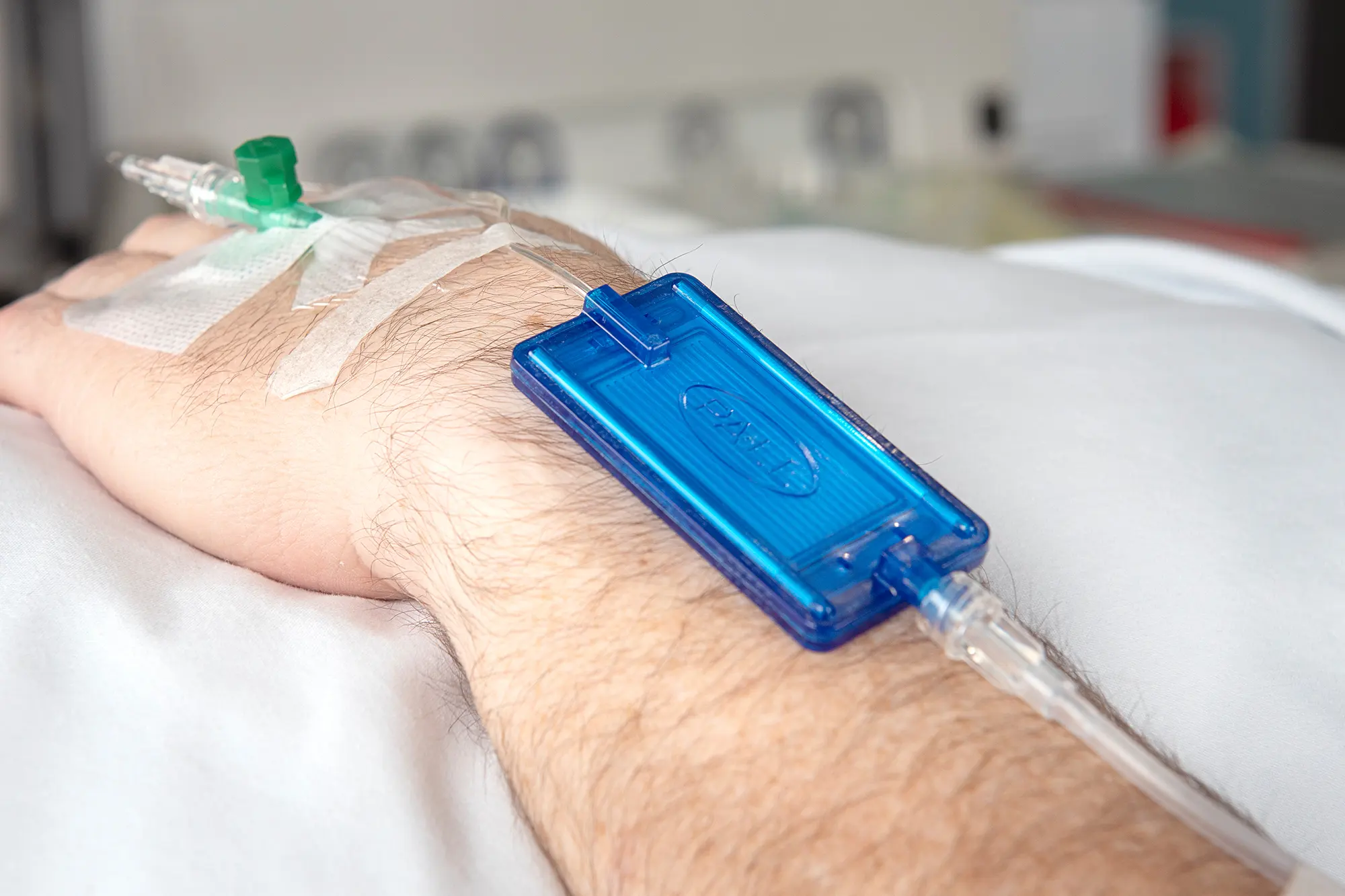 Inline IV filter connected to an intravenous line for parenteral nutrition safety