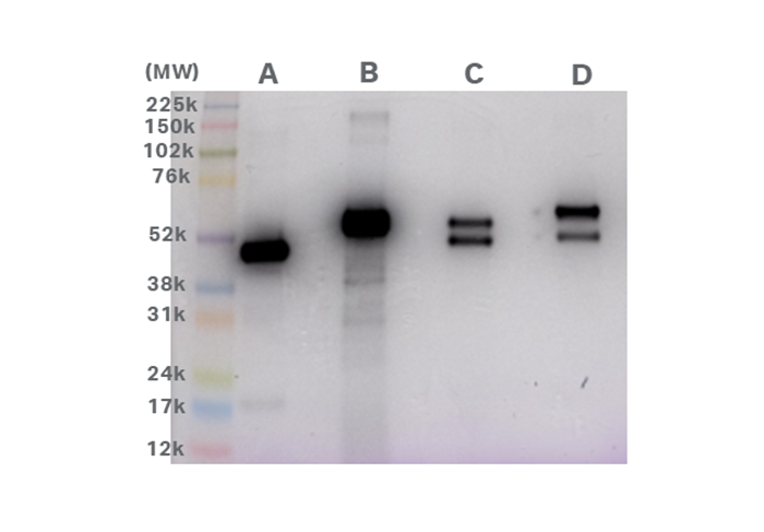 1D SDS-PAGE with CyDye™ DIGE Cy™5 pre-labelled samples