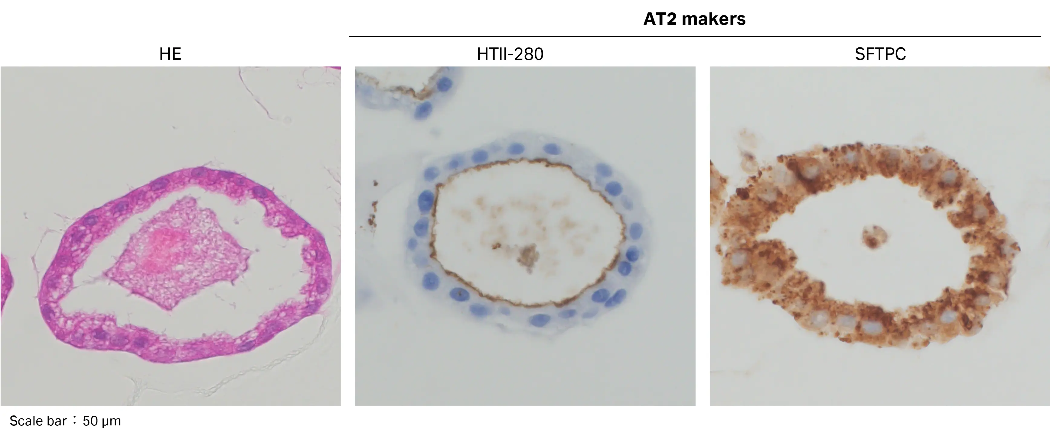 CytoFLEX SRTで細胞を分取後の12日間培養したオルガノイドの免疫染色。(左)HE染色、(中)HTll-280、(右)SFTPCを示す。