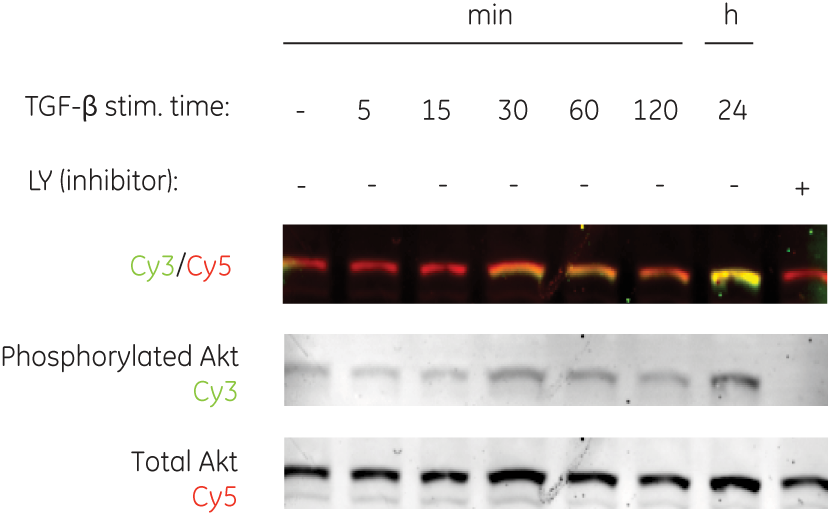 Multiple protein molecule detection of two forms of human Akt protein fluorescent western blot principle