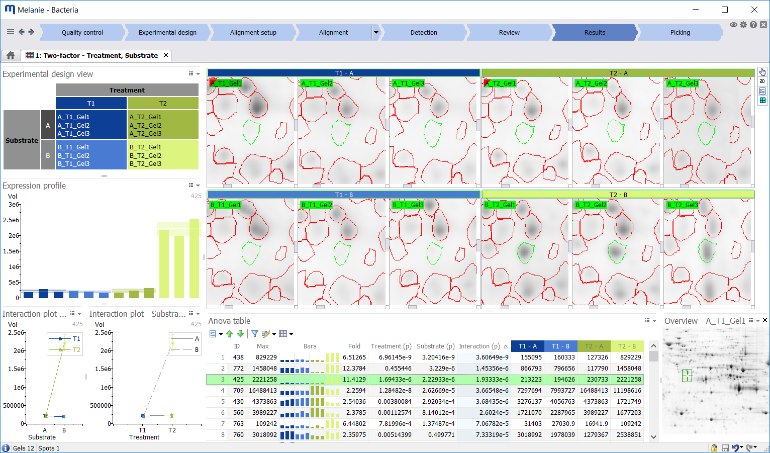Melanie 9 2-D Gel Analysis Software screen shot