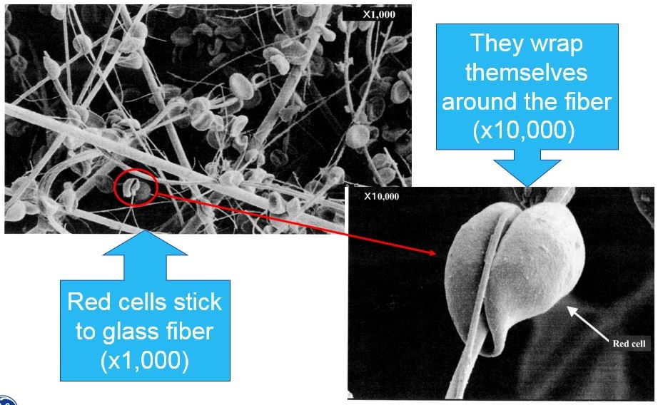 Diagnostic assays Blood separation using depth filters Cytiva