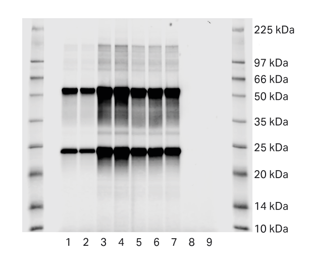 蛋白 A 步骤后 SDS-PAGE 分析。空白运行为样品 8 和 9。