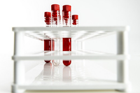 Liquid biopsy clinical trials