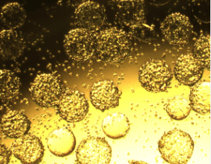 Obio 案例研究 来自微载体细胞的 AAV 光学显微镜图像
