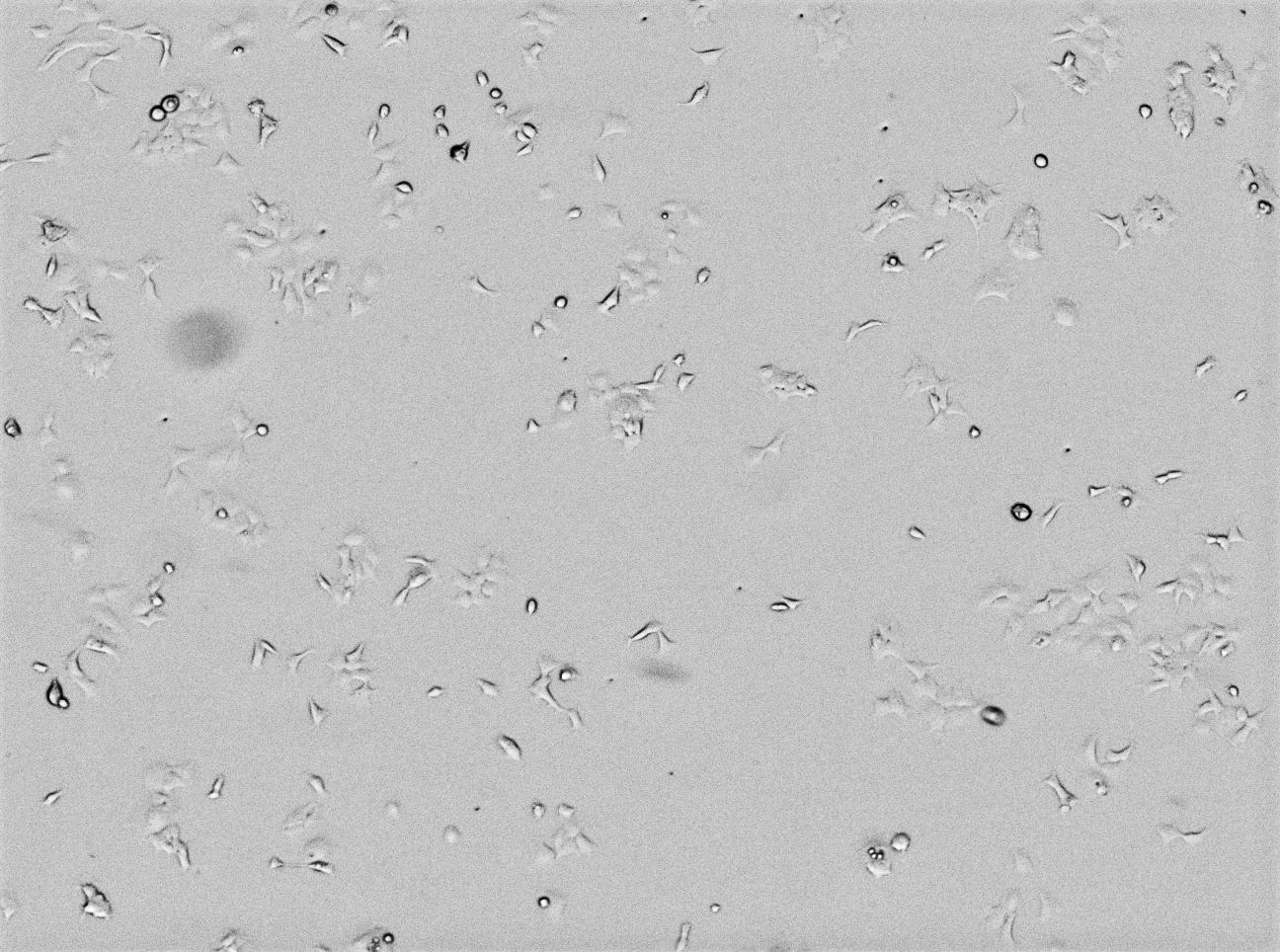 Confluence and morphology of MRC-5, VERO, and HEK-293 adherent cells grown in HyClone™ Characterized FBS serum treated at either  20°C or 40°C.