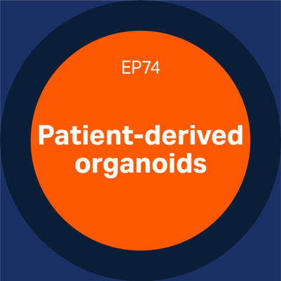 Episode 74 - Patient-derived organoids