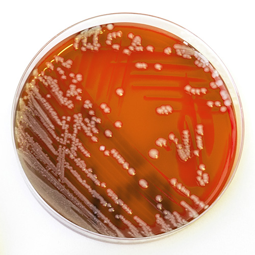 Bacteria colonies in Petri Dishes