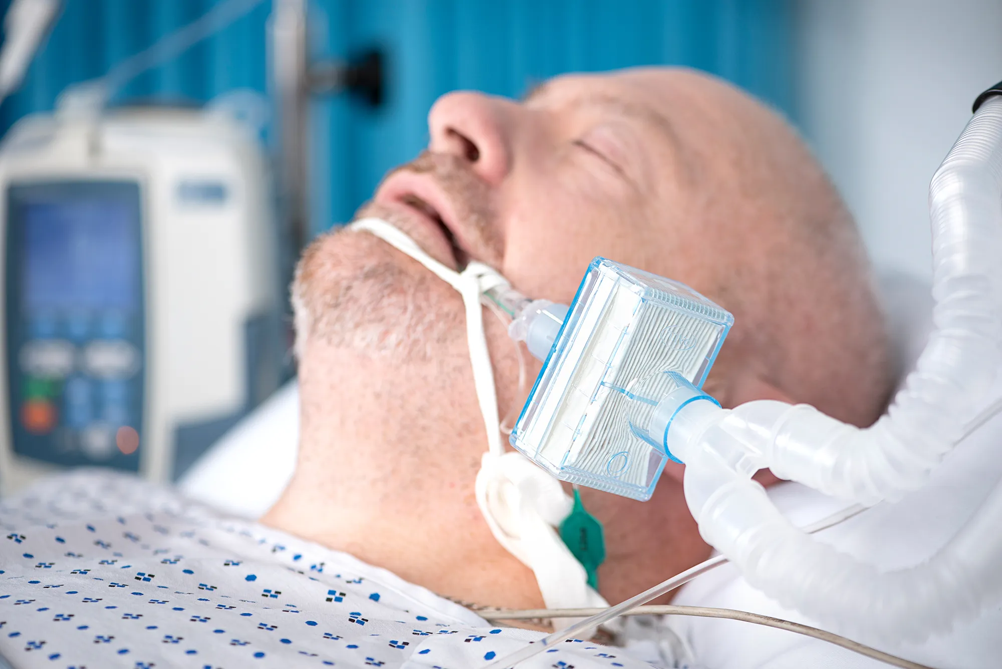  Pall Breathing System Filters are engineered to the highest performance and quality standards for anaesthesia and intensive care and sit at both patient and machine side t